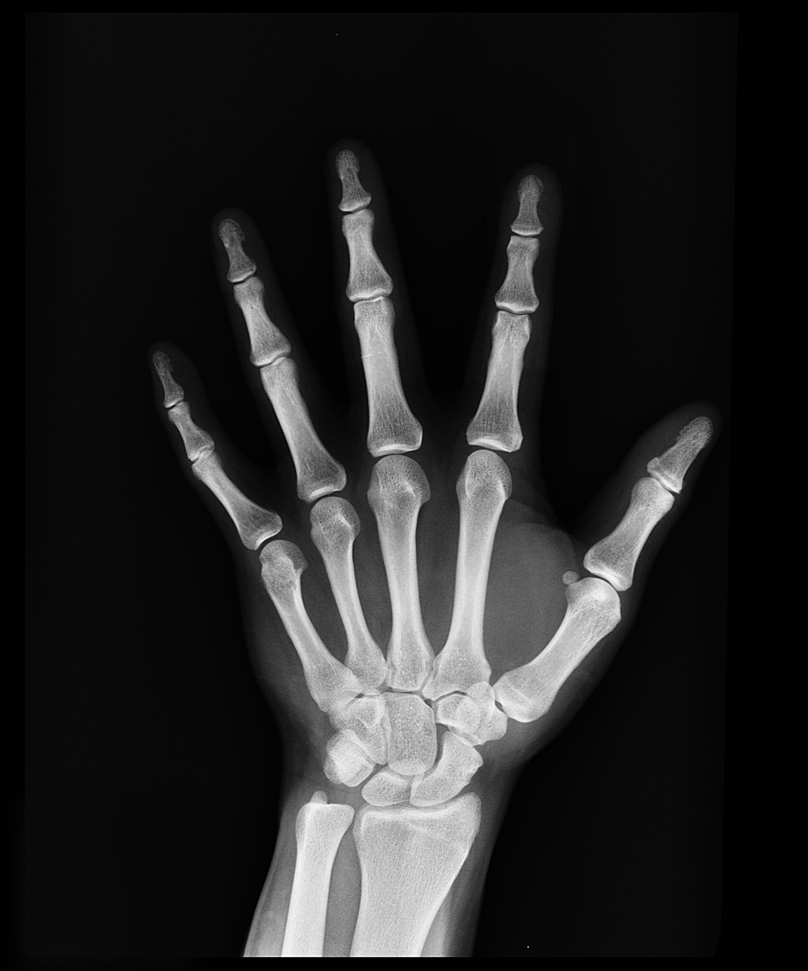 hand_skeleton